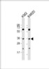 Western Blot at 1:2000 dilution Lane 1: K562 whole cell lysate Lane 2: SW620 whole cell lysate Lysates/proteins at 20 ug per lane.