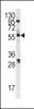 Western blot analysis of anti-PLK Pab in A375 cell lysate