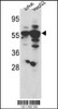Western blot analysis of hSGKL-K123 (SGK3) in Jurkat and HepG2 cell line lysates (35ug/lane)