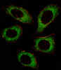 Fluorescent image of U251 cell stained with MAP2K2 Antibody (T394) . U251 cells were fixed with 4% PFA (20 min) , permeabilized with Triton X-100 (0.1%, 10 min) , then incubated with MAP2K2 primary antibody (1:25) . For secondary antibody, Alexa Fluor 488 conjugated donkey anti-rabbit antibody (green) was used (1:400) .Cytoplasmic actin was counterstained with Alexa Fluor 555 (red) conjugated Phalloidin (7units/ml) . MAP2K2 immunoreactivity is localized to Cytoplasm significantly.