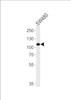Western blot analysis in SW480 cell line lysates (35ug/lane) .
