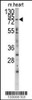 Western blot analysis of anti-MYLK3 Antibody in mouse heart tissue lysates (35ug/lane) .