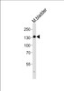 Western blot analysis of lysate from mouse bladder tissue lysate, using MLCKlong Antibody (M1) at 1:1000.