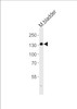 Western blot analysis of lysate from mouse bladder tissue lysate, using MLCKlong Antibody (M1) at 1:1000.