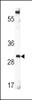 Western blot analysis of BDNF Antibody in CEM cell line lysates (35ug/lane)