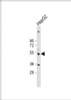 Western Blot at 1:2000 dilution + HepG2 whole cell lysate Lysates/proteins at 20 ug per lane.