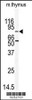 Western blot analysis of anti-EMK Antibody in mouse thymus tissue lysates (35ug/lane)