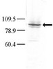 Western blot analysis of anti-GLK Pab in Hela cell lysate. Dilution for anti-GLK was 1:100; dilution for secondary goat anti-rabbit-HRP was 1:7000. A chemiluminescent kit was used for development of the Western blot. Data and protocol courtesy of Dr. Richard Lu, Partners HealthCare System at Harvard University.