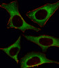 Fluorescent image of Hela cell stained with PI3KCD Antibody .Hela cells were fixed with 4% PFA (20 min) , permeabilized with Triton X-100 (0.1%, 10 min) , then incubated with PI3KCD primary antibody (1:25) . For secondary antibody, Alexa Fluor 488 conjugated donkey anti-rabbit antibody (green) was used (1:400) .Cytoplasmic actin was counterstained with Alexa Fluor 555 (red) conjugated Phalloidin (7units/ml) .PI3KCD immunoreactivity is localized to Cytoplasm significantly.