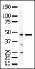 Antibody is used in Western blot to detect PIP5K2A in mouse skeletal muscle tissue lysate.