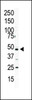 Western blot analysis of anti-PIP5K2A Pab in HL60 cell lysate