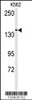 Antibody is used in Western blot to detect CHAK1 in K562 cell lysate.