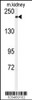 Western blot analysis of anti-CHAK1 Antibody in mouse kidney tissue lysates (35ug/lane)