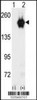 Western blot analysis of GAK using GAK Antibody using 293 cell lysates (2 ug/lane) either nontransfected (Lane 1) or transiently transfected with the GAK gene (Lane 2) .