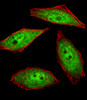 Fluorescent image of U251 cells stained with hNEK2-C410 . Antibody was diluted at 1:25 dilution. An Alexa Fluor 488-conjugated goat anti-rabbit lgG at 1:400 dilution was used as the secondary antibody (green) . Cytoplasmic actin was counterstained with Alexa Fluor 555 conjugated with Phalloidin (red) .