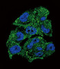 Confocal immunofluorescent analysis of NM23 (NME1) Antibody with A375 cell followed by Alexa Fluor 488-conjugated goat anti-rabbit lgG (green) .DAPI was used to stain the cell nuclear (blue) .