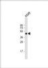 Western Blot at 1:1000 dilution + A549 whole cell lysate Lysates/proteins at 20 ug per lane.