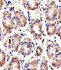 Immunohistochemical analysis of paraffin-embedded H. stomach section using PACSIN2 Antibody . Antibody was diluted at 1:25 dilution. A peroxidase-conjugated goat anti-rabbit IgG at 1:400 dilution was used as the secondary antibody, followed by DAB staining.