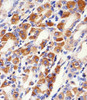 Immunohistochemical analysis of paraffin-embedded H.stomach section using PACSIN2 Antibody . Antibody was diluted at 1:100 dilution. A peroxidase-conjugated goat anti-rabbit IgG at 1:400 dilution was used as the secondary antibody, followed by DAB staining.