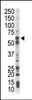 Antibody is used in Western blot to detect PCK1 in mouse liver tissue lysate.