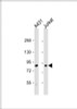 Western Blot at 1:1000 dilution Lane 1: A431 whole cell lysate Lane 2: Jurkat whole cell lysate Lysates/proteins at 20 ug per lane.