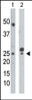 Antibody is used in Western blot to detect UCK in mouse cerebellum tissue lysate (Lane 1) and HepG2 cell lysate (Lane 2) .