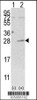 Western blot analysis of AK3 using rabbit polyclonal AK3 Antibody (C-term H38) using 293 cell lysates (2 ug/lane) either nontransfected (Lane 1) or transiently transfected with the AK3 gene (Lane 2) .