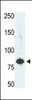 Antibody is used in Western blot to detect PFKL in HepG2 cell lysate.