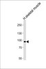 Western blot analysis of lysate from human skeletal muscle tissue lysate, using PFKM Antibody （S137） at 1:1000 at each lane.