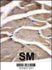 Formalin-fixed and paraffin-embedded human skeletal muscle reacted with PFKM Antibody, which was peroxidase-conjugated to the secondary antibody, followed by DAB staining.