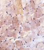 Immunohistochemical analysis of paraffin-embedded H. skeletal muscle section using HK2 (Hexokinase II) Antibody . Antibody was diluted at 1:100 dilution. A undiluted biotinylated goat polyvalent antibody was used as the secondary, followed by DAB staining.