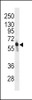 Western blot analysis of anti-PFKFB3 Antibody in CEM cell line lysates (35ug/lane) .