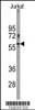 Western blot analysis of anti-PFKFB1 Antibody in Jurkat cell line lysates (35ug/lane) .