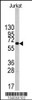 Western blot analysis of anti-PFKFB1 Antibody in Jurkat cell line lysates (35ug/lane) .