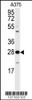 Western blot analysis of anti-14-3-3 protein zeta/delta Anbtibody (T232) in A375 cell line lysates (35ug/lane)