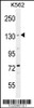 Western blot analysis in K562 cell line lysates (35ug/lane) .