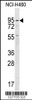 Western blot analysis of anti-GUCY1A2 Antibody in NCI-H460 cell line lysates (35ug/lane)