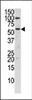 Western blot analysis of anti-CHK in HepG2 cell line lysate (35ug/lane)