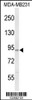 Western blot analysis of PIK3CG Antibody in MDA-MB231 cell line lysates (35ug/lane)