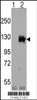 Western blot analysis of TRPM8 using rabbit polyclonal TRPM8 Antibody.293 cell lysates (2 ug/lane) either nontransfected (Lane 1) or transiently transfected with the TRPM8 gene (Lane 2) .