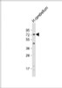 Western Blot at 1:1000 dilution + human cerebellum lysate Lysates/proteins at 20 ug per lane.