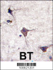 Formalin-fixed and paraffin-embedded human brain tissue reacted with hPCPTP1-Y249, which was peroxidase-conjugated to the secondary antibody, followed by DAB staining.