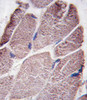 Formalin-fixed and paraffin-embedded human skeletal muscle tissue reacted with PTPD1 antibody, which was peroxidase-conjugated to the secondary antibody, followed by DAB staining.