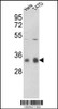 Western blot analysis of hPPP1CC-A306 in Hela, T47D cell line lysates (35ug/lane)