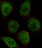Fluorescent image of U251 cell stained with PPP1CB Antibody .U251 cells were fixed with 4% PFA (20 min) , permeabilized with Triton X-100 (0.1%, 10 min) , then incubated with PPP1CB primary antibody (1:25) . For secondary antibody, Alexa Fluor 488 conjugated donkey anti-rabbit antibody (green) was used (1:400) .Cytoplasmic actin was counterstained with Alexa Fluor 555 (red) conjugated Phalloidin (7units/ml) .PPP1CB immunoreactivity is localized to Cytoplasm and Nucleus significantly.