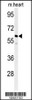 Western blot analysis of hPPM1G-C164 in mouse heart tissue lysates (35ug/lane)