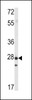 Western blot analysis of PRL1 in mouse spleen tissue lysates (35ug/lane)