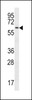 Western blot analysis in HepG2 cell line lysates (35ug/lane) .This demonstratesdetected the cdc14 protein (arrow) .