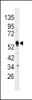 Western blot analysis of anti-DUSP4 Antibody in HepG2 cell line lysates (35ug/lane)