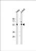 Western Blot at 1:1000 dilution Lane 1: Hela whole cell lysate Lane 2: Jurkat whole cell lysate Lysates/proteins at 20 ug per lane.